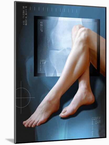 Woman's Legs, with Knee X-ray-Miriam Maslo-Mounted Photographic Print