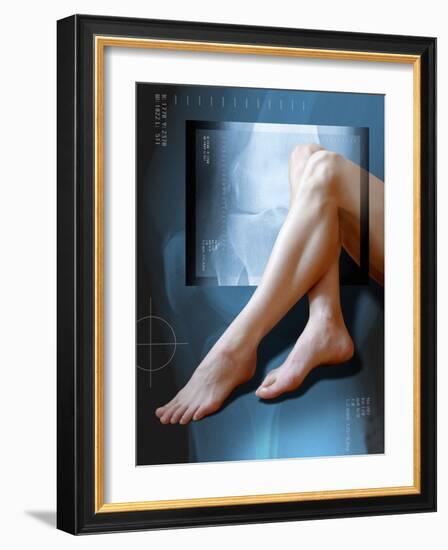 Woman's Legs, with Knee X-ray-Miriam Maslo-Framed Photographic Print