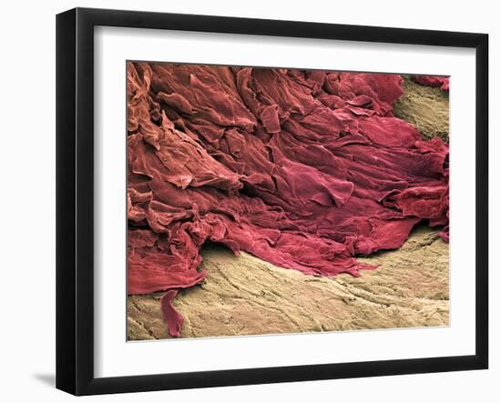 Wound Scab, SEM-Steve Gschmeissner-Framed Photographic Print