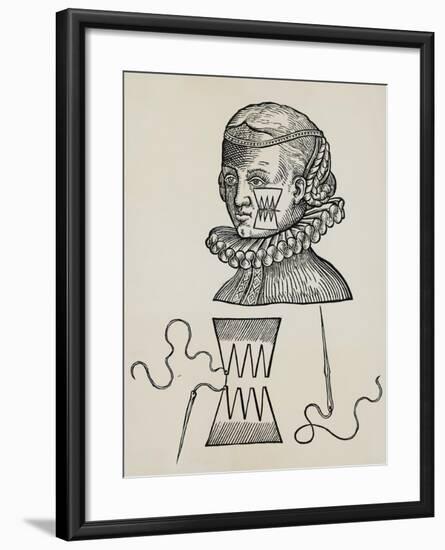 Wound to Cheek Treated with Plasters to Prevent Traces of Stitch Marks on Skin, 1579,-null-Framed Giclee Print