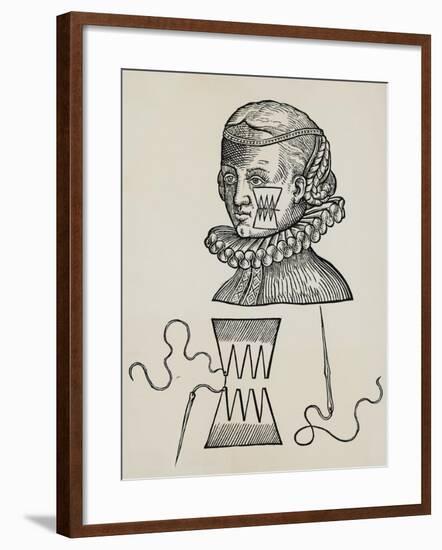 Wound to Cheek Treated with Plasters to Prevent Traces of Stitch Marks on Skin, 1579,-null-Framed Giclee Print