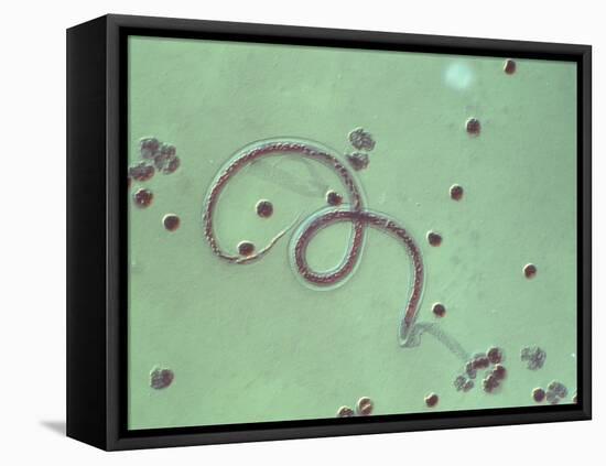 Wuchereria Bancrofti Parasite-Sinclair Stammers-Framed Premier Image Canvas