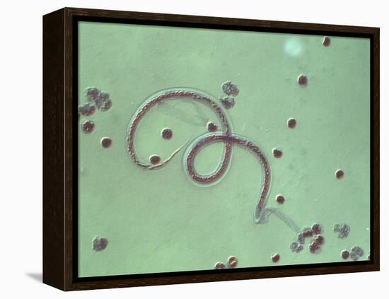 Wuchereria Bancrofti Parasite-Sinclair Stammers-Framed Premier Image Canvas