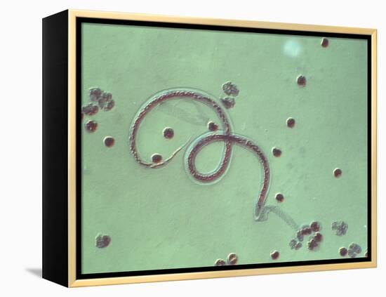 Wuchereria Bancrofti Parasite-Sinclair Stammers-Framed Premier Image Canvas