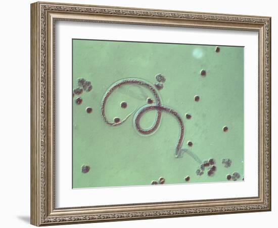 Wuchereria Bancrofti Parasite-Sinclair Stammers-Framed Photographic Print