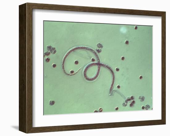 Wuchereria Bancrofti Parasite-Sinclair Stammers-Framed Photographic Print