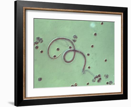 Wuchereria Bancrofti Parasite-Sinclair Stammers-Framed Photographic Print