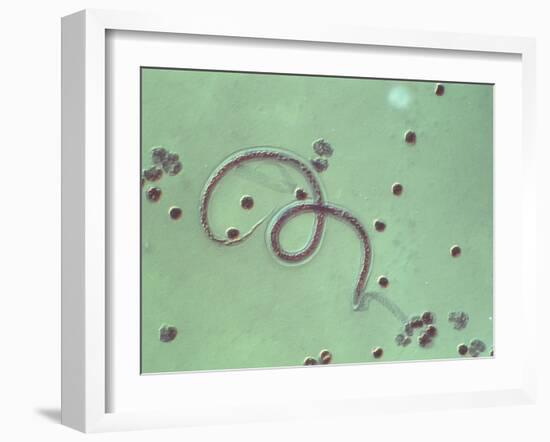 Wuchereria Bancrofti Parasite-Sinclair Stammers-Framed Photographic Print