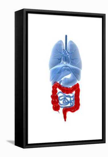 X-Ray Image of Internal Organs with Large Intestine Highlighted in Red-null-Framed Stretched Canvas