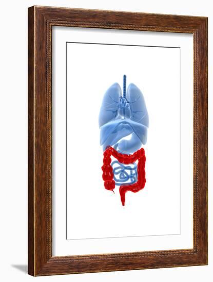 X-Ray Image of Internal Organs with Large Intestine Highlighted in Red-null-Framed Art Print