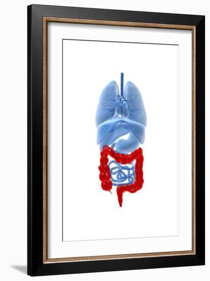 X-Ray Image of Internal Organs with Large Intestine Highlighted in Red-null-Framed Art Print