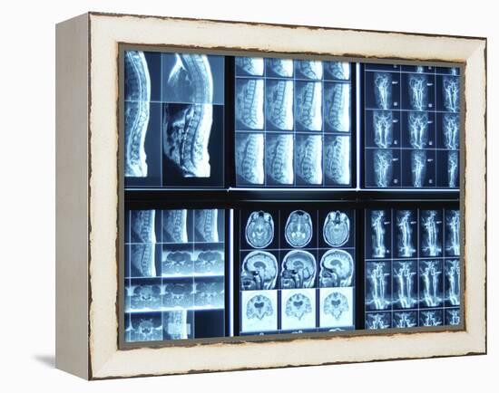 X-Ray Images on Computer Screen-null-Framed Premier Image Canvas