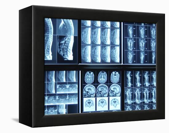 X-Ray Images on Computer Screen-null-Framed Premier Image Canvas