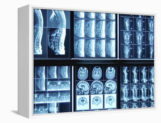 X-Ray Images on Computer Screen-null-Framed Premier Image Canvas