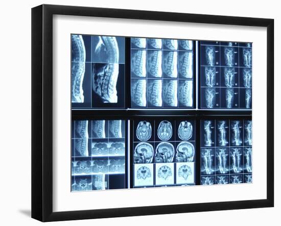 X-Ray Images on Computer Screen-null-Framed Photographic Print