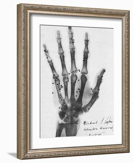 X-ray of a hand with buckshot-Science Source-Framed Giclee Print