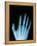 X-Ray of a Hand-Robert Llewellyn-Framed Premier Image Canvas