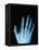 X-Ray of a Hand-Robert Llewellyn-Framed Premier Image Canvas