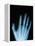 X-Ray of a Hand-Robert Llewellyn-Framed Premier Image Canvas