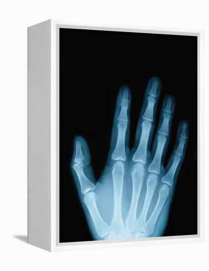 X-Ray of a Hand-Robert Llewellyn-Framed Premier Image Canvas