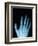 X-Ray of a Hand-Robert Llewellyn-Framed Photographic Print