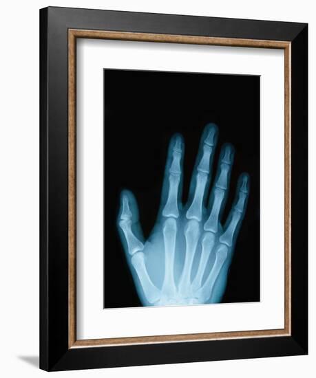 X-Ray of a Hand-Robert Llewellyn-Framed Photographic Print