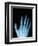 X-Ray of a Hand-Robert Llewellyn-Framed Photographic Print