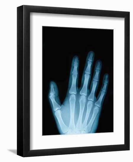 X-Ray of a Hand-Robert Llewellyn-Framed Photographic Print