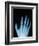 X-Ray of a Hand-Robert Llewellyn-Framed Photographic Print