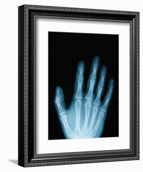 X-Ray of a Hand-Robert Llewellyn-Framed Photographic Print