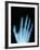 X-Ray of a Hand-Robert Llewellyn-Framed Photographic Print