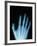 X-Ray of a Hand-Robert Llewellyn-Framed Photographic Print