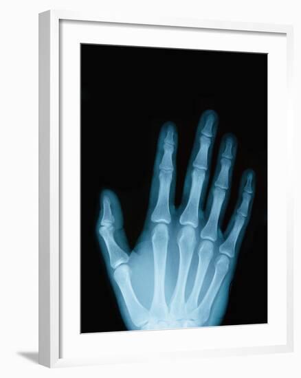 X-Ray of a Hand-Robert Llewellyn-Framed Photographic Print