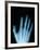 X-Ray of a Hand-Robert Llewellyn-Framed Photographic Print