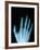 X-Ray of a Hand-Robert Llewellyn-Framed Photographic Print