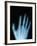 X-Ray of a Hand-Robert Llewellyn-Framed Photographic Print