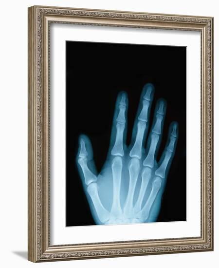 X-Ray of a Hand-Robert Llewellyn-Framed Photographic Print