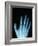 X-Ray of a Hand-Robert Llewellyn-Framed Photographic Print