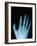 X-Ray of a Hand-Robert Llewellyn-Framed Photographic Print