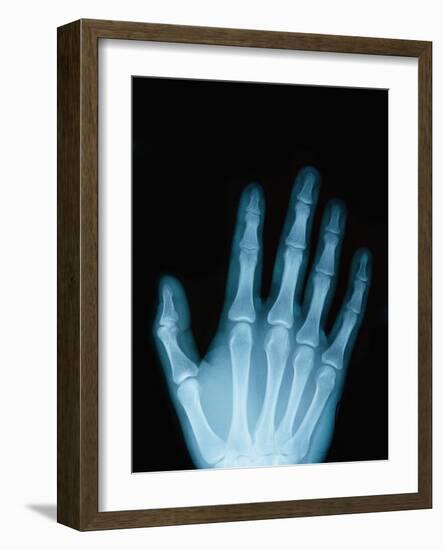 X-Ray of a Hand-Robert Llewellyn-Framed Photographic Print