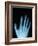 X-Ray of a Hand-Robert Llewellyn-Framed Photographic Print