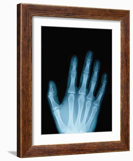 X-Ray of a Hand-Robert Llewellyn-Framed Photographic Print