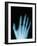 X-Ray of a Hand-Robert Llewellyn-Framed Photographic Print