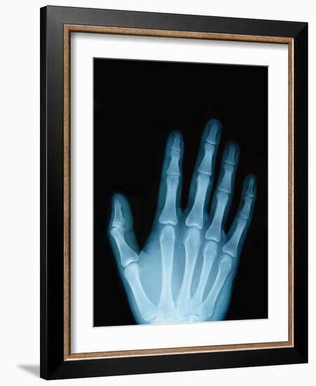 X-Ray of a Hand-Robert Llewellyn-Framed Photographic Print