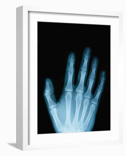 X-Ray of a Hand-Robert Llewellyn-Framed Photographic Print