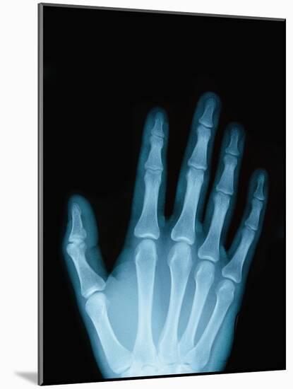 X-Ray of a Hand-Robert Llewellyn-Mounted Photographic Print