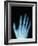 X-Ray of a Hand-Robert Llewellyn-Framed Photographic Print