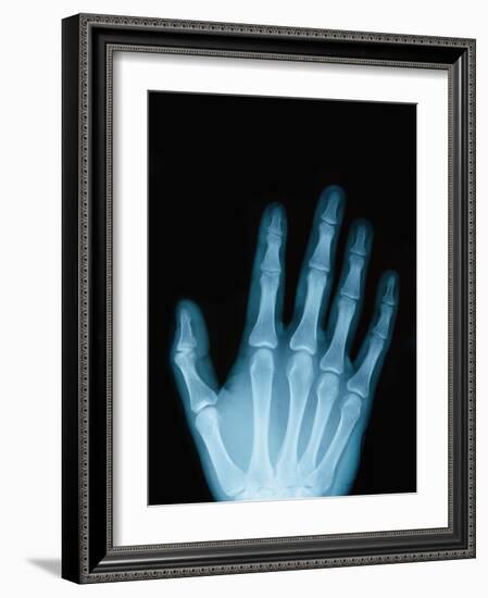 X-Ray of a Hand-Robert Llewellyn-Framed Photographic Print