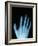 X-Ray of a Hand-Robert Llewellyn-Framed Photographic Print