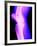 X-Ray of a Knee-null-Framed Photographic Print